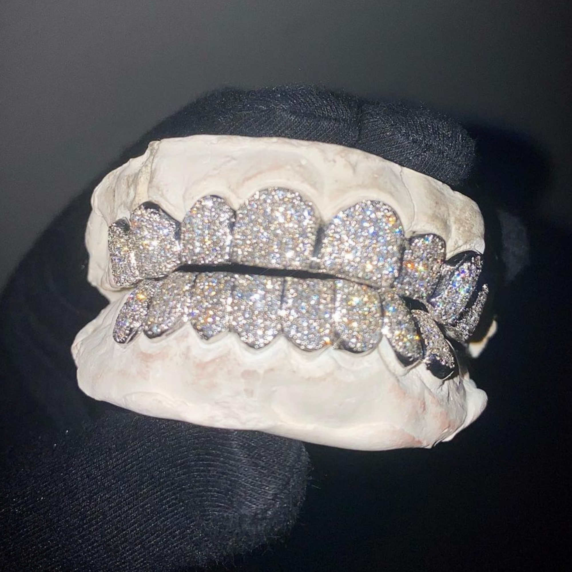 Fully Iced Out Diamond Teeth Grillz – High Sparkle Hip-Hop Jewelry Set