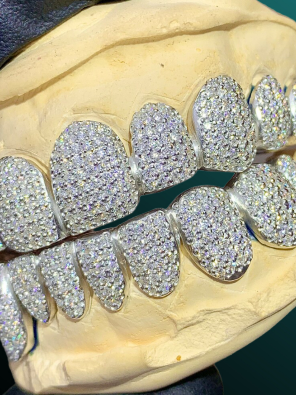 Gold Drip Diamond Style Teeth Grillz – Bold Hip-Hop Style Accessory