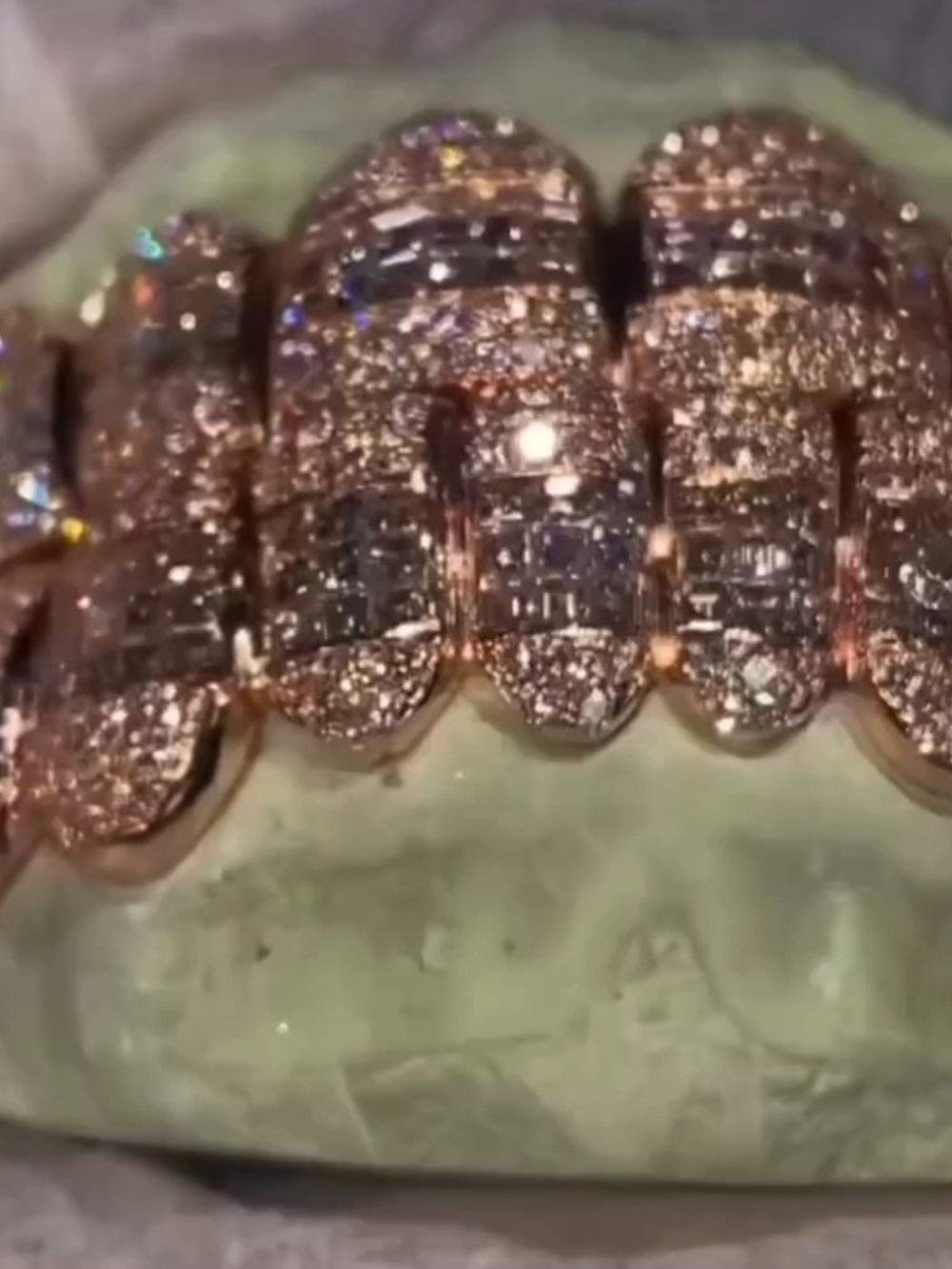 VVS Moissanite Premium Shine Teeth Grillz – Handcrafted High Clarity Grillz