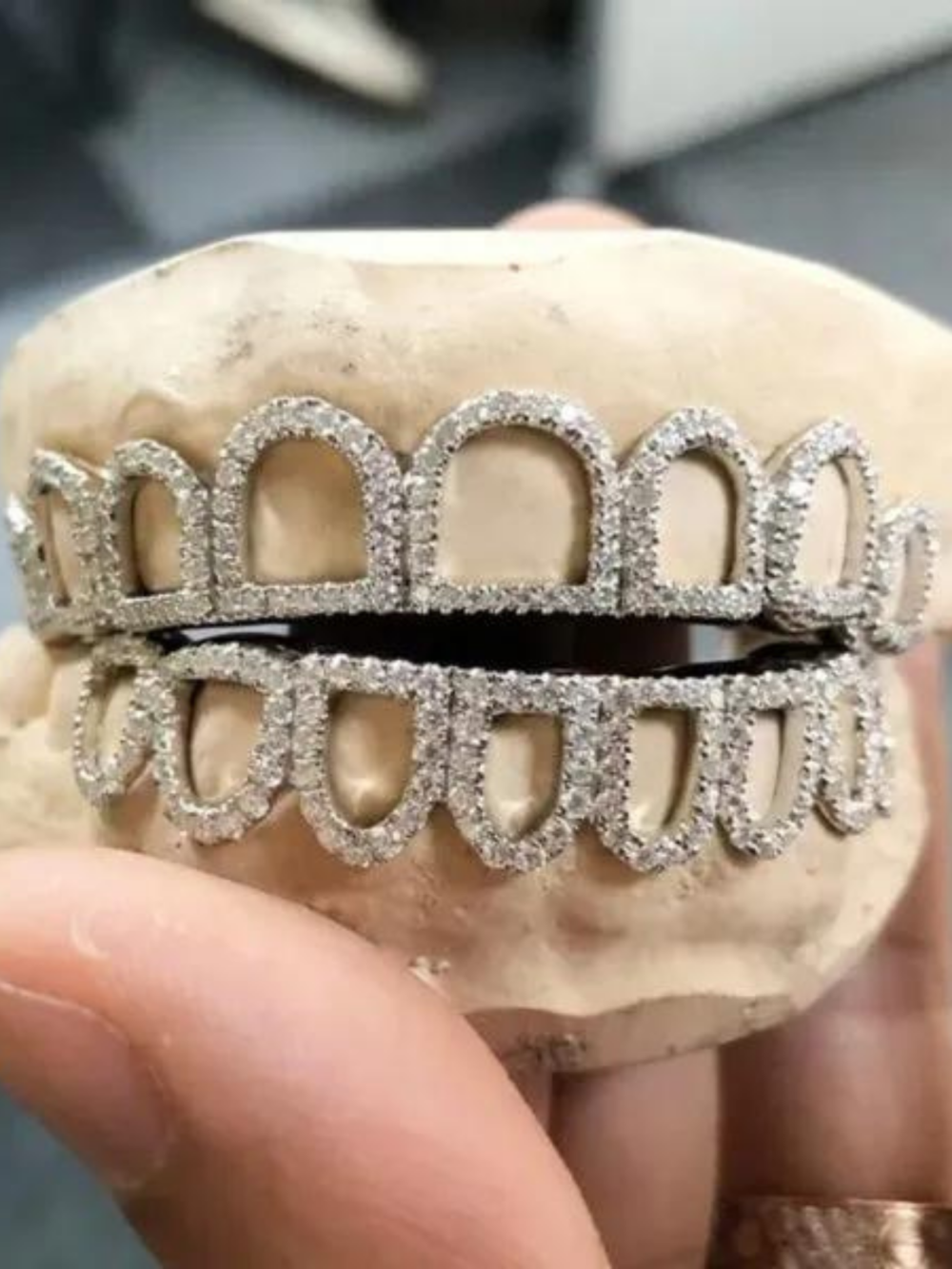 Moissanite Premium Iced Out Teeth Grillz – Luxury Hip-Hop Shine Set