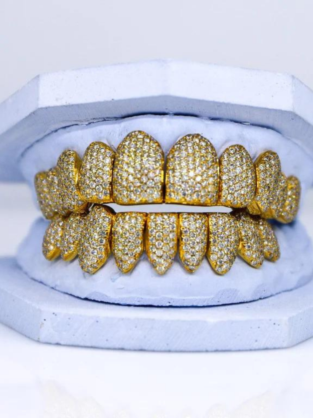 Sterling Silver Custom Fit Teeth Grillz – Clean Look with Silver Luster