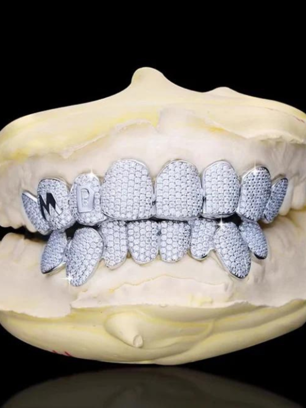 Premium Moissanite Diamond Teeth Grillz – High Sparkle Luxury Finish