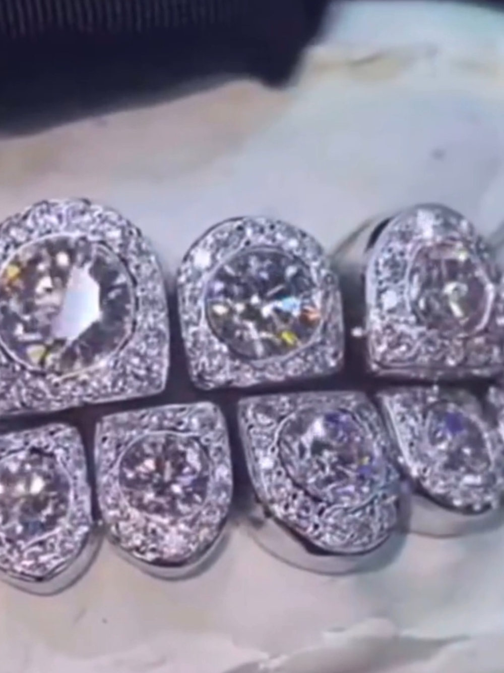 Iced Out Diamond Teeth Grillz – Full Stone Set High Flash Grillz