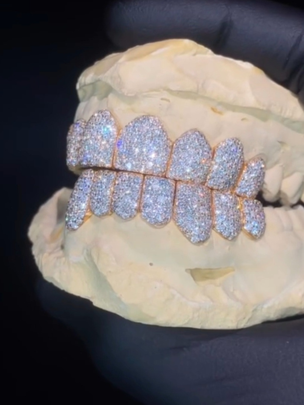 Moissanite Diamond Hip-Hop Teeth Grillz – Ultra Sparkle Realistic Shine