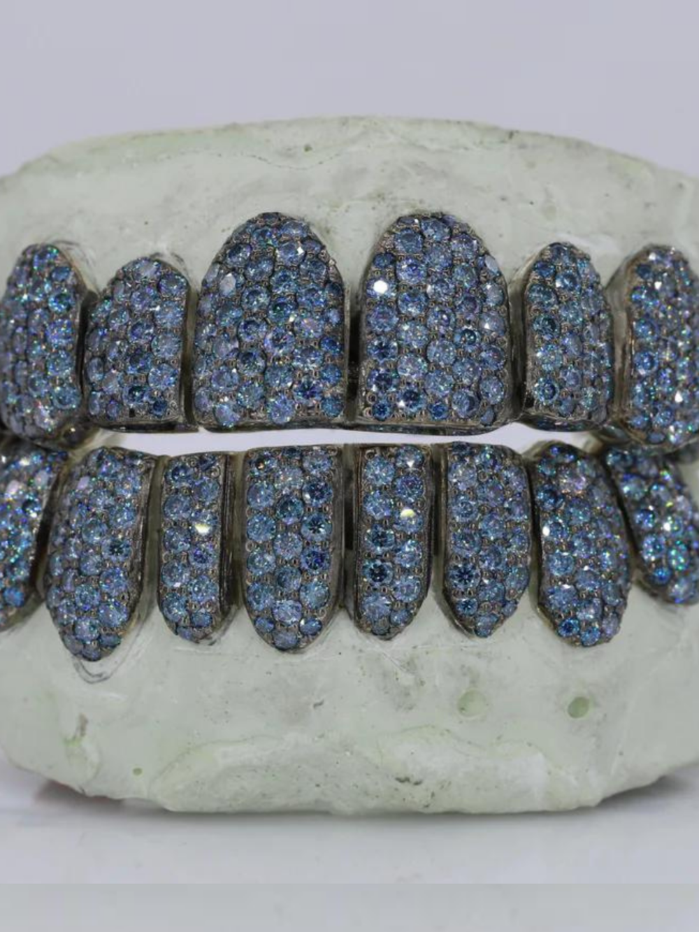 18K Gold Heavy Shine Teeth Grillz – Rich Color & Stylish Look