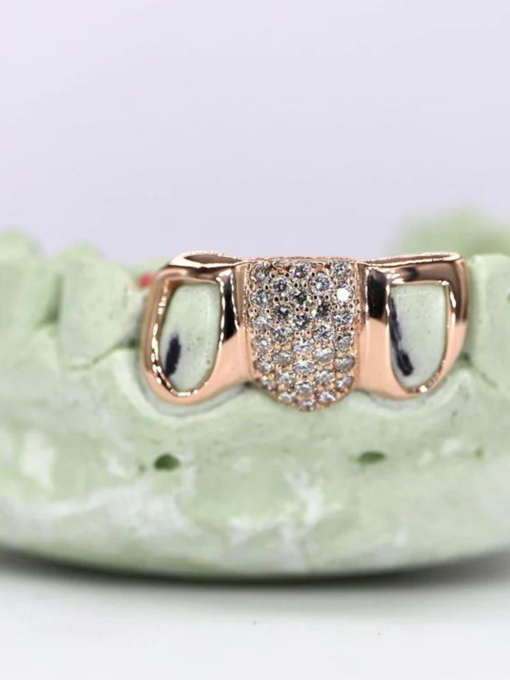 Full Moissanite Diamond Shine Teeth Grillz – Ultra-Premium Hip-Hop Jewelry