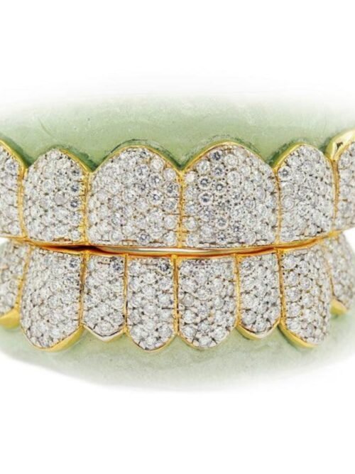 diamond teeth