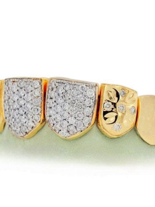 Diamond Grillz on Teeth