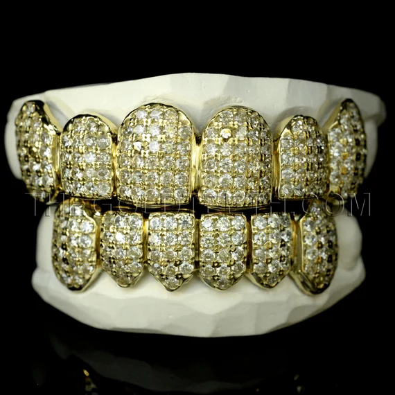 Iced Out Grillz: Everything You Need to Know About the Hottest Hip-Hop Jewelry Trend