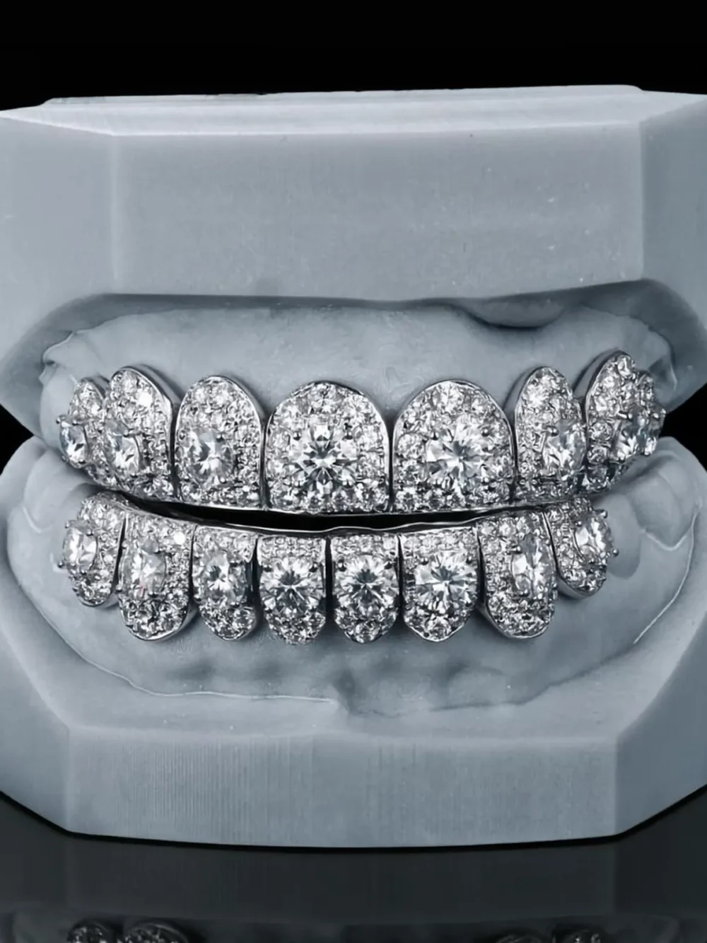 icedout teeth grillz1