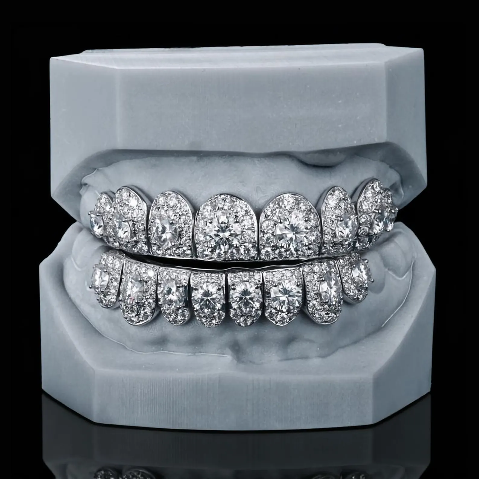 icedout teeth grillz1